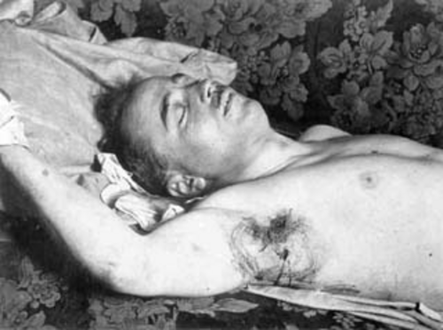 NS-Juliputsch 1934: Leichnam des ermordeten Bundeskanzlers Dollfuß